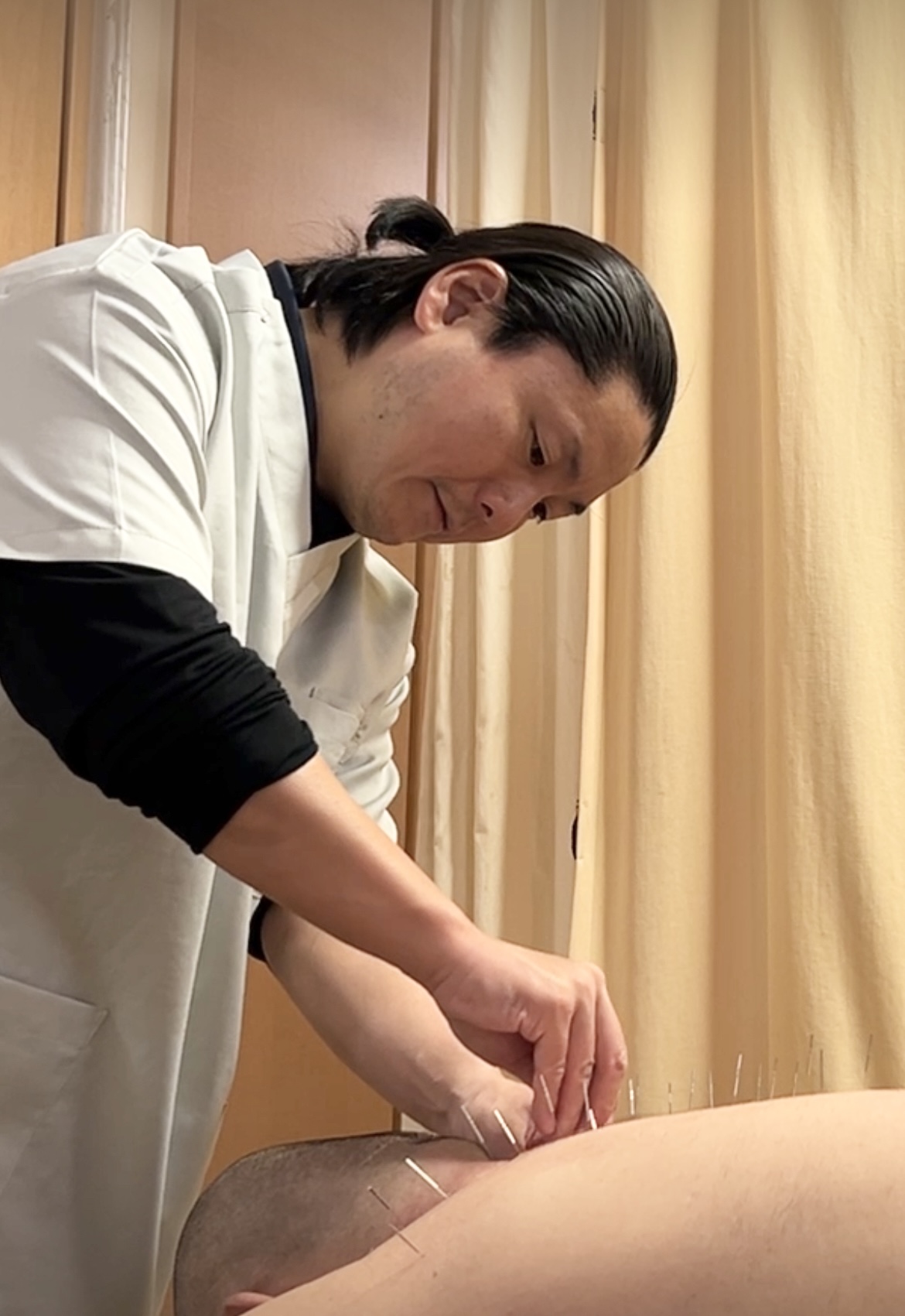 やわらげ鍼灸roomでの鍼灸施術風景